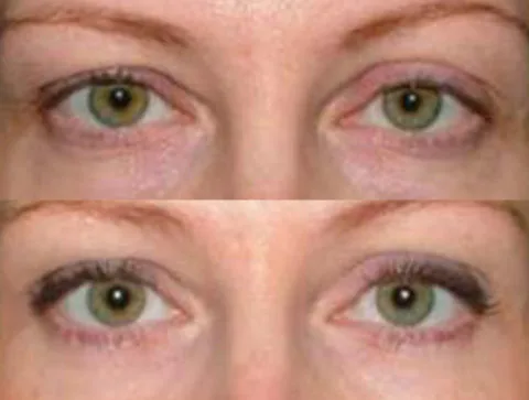 Before / After — 1
