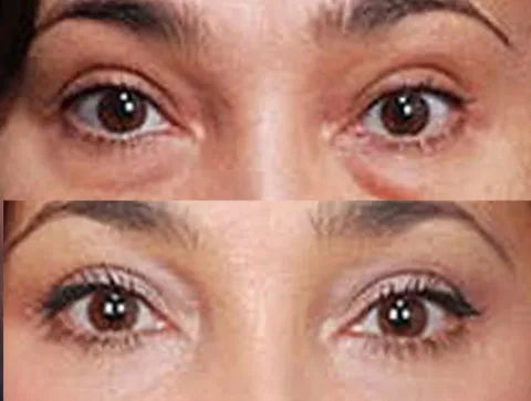 Before / After — 2