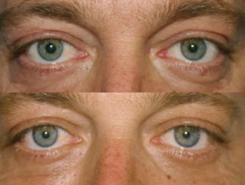 Before / After — 3